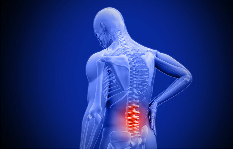 Chronic Back Pain Therapy Treatment Innovative Therapy Canada